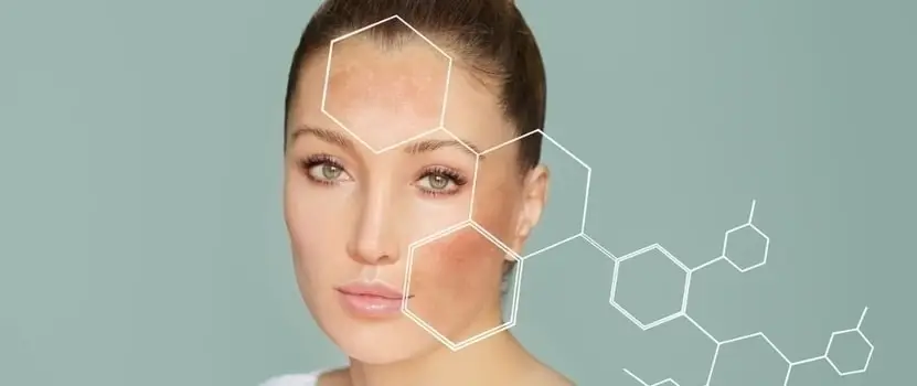 Sun Damaged Skin Treatment