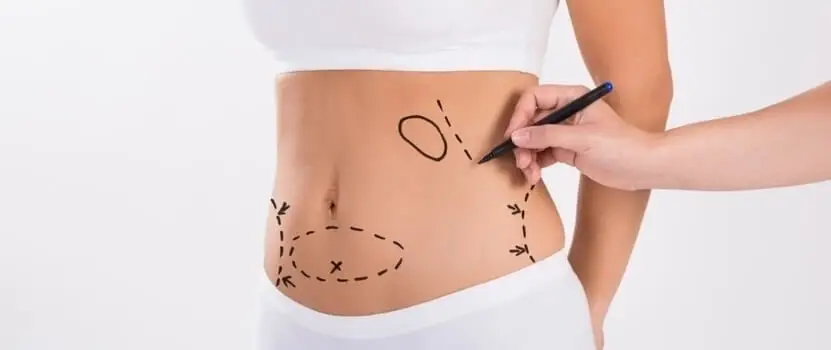 Tummy Tuck Recovery