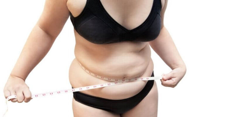 Tummy Tucks and Pregnancy