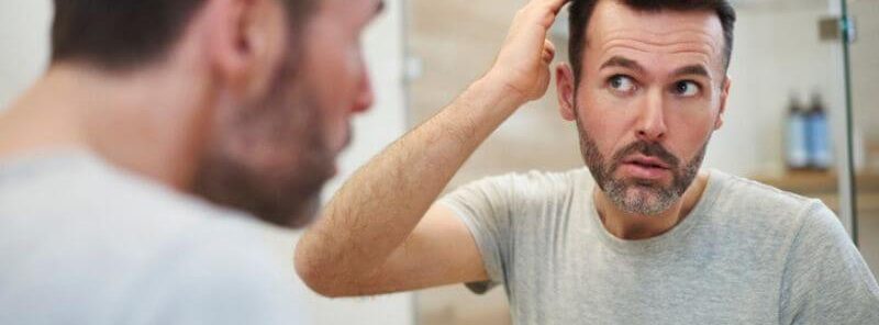 Early Signs of Balding Hair Loss