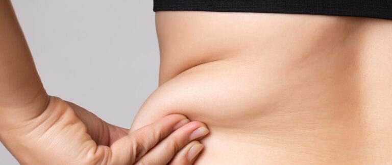 Liposuction Requirements