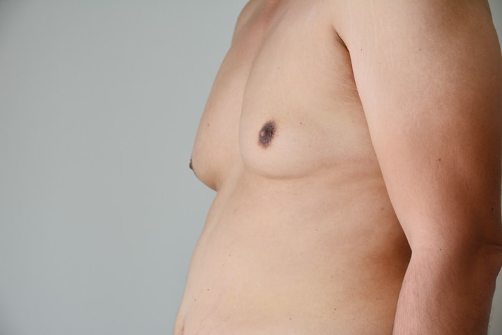 health benefits of liposuction