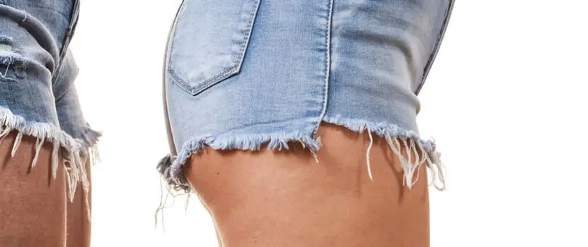 2 Types of Cellulite & How to Treat Them