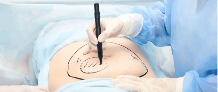 Can I Transfer My Own Fat to My Butt?