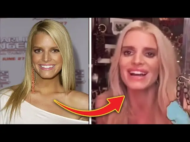 Ozempic face