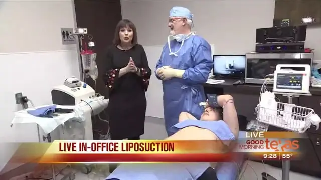 A doctor in scrubs and a woman in black stand in a medical office during a live TV segment, while a patient receives liposuction dallas. Medical equipment is visible, and a TV banner reads LIVE IN-OFFICE LIPOSUCTION.