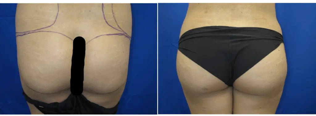 Done Is Dead: The Rise of Natural Cosmetic Beauty Done Is Dead: The Rise of Natural Cosmetic Beauty